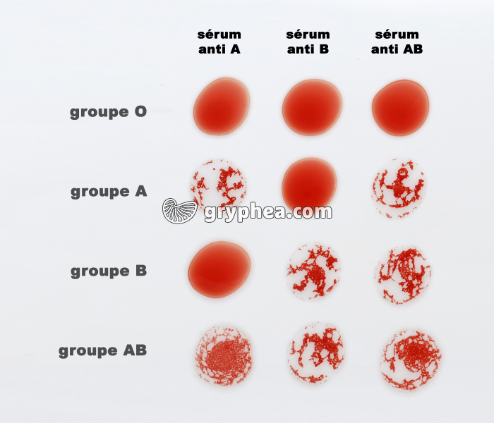 Détermination des groupes sanguins (par sérum-test) - gryphea.com
